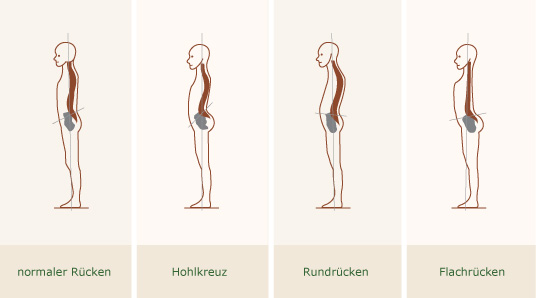 [verlinkte Grafik wurde nicht gefunden]